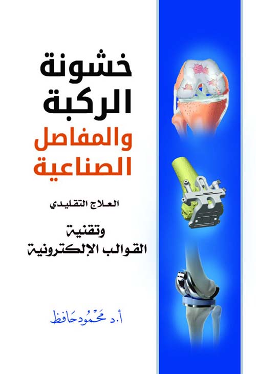 خشونة الركبة والمفاصل الصناعية " العلاج التقليدي وتقنية القوالب الإلكترونية "